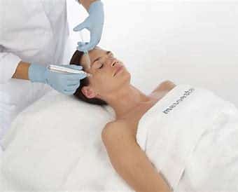 Combined Meseotetic Skin Peel & Microneedling Offer